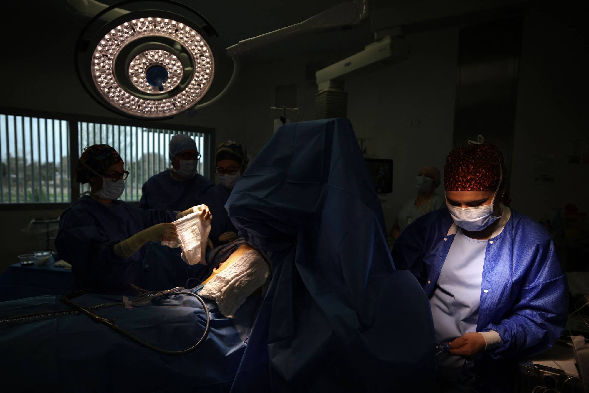 دراسة: استئصال الزائدة الدودية الملتهبة قد يقلل خطر الإصابة بسرطان القولون