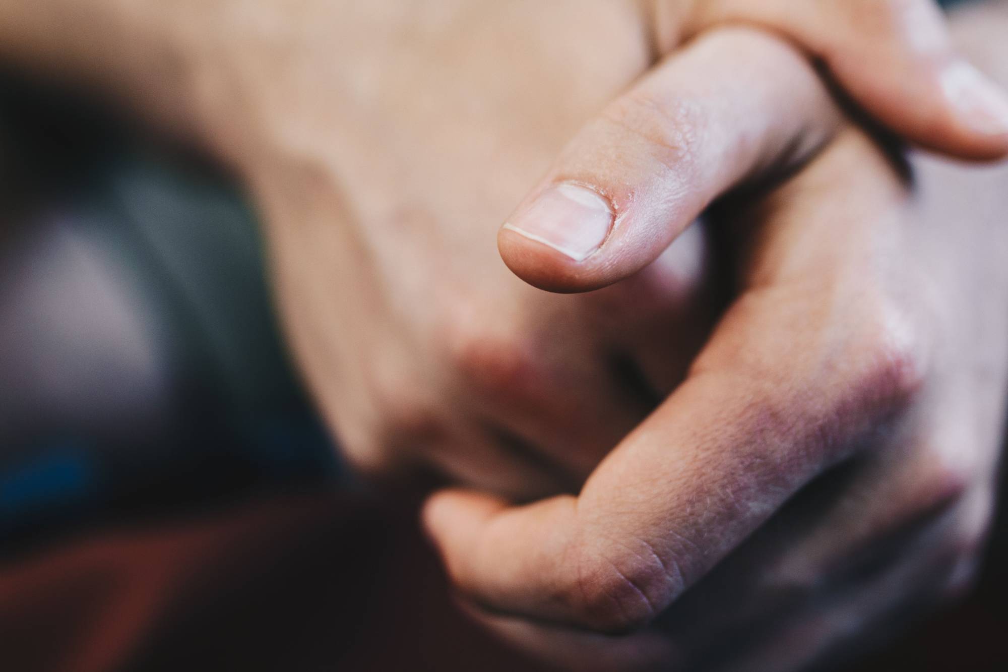 علامة في الأظافر قد تشير إلى الإصابة بأمراض القلب والسرطان