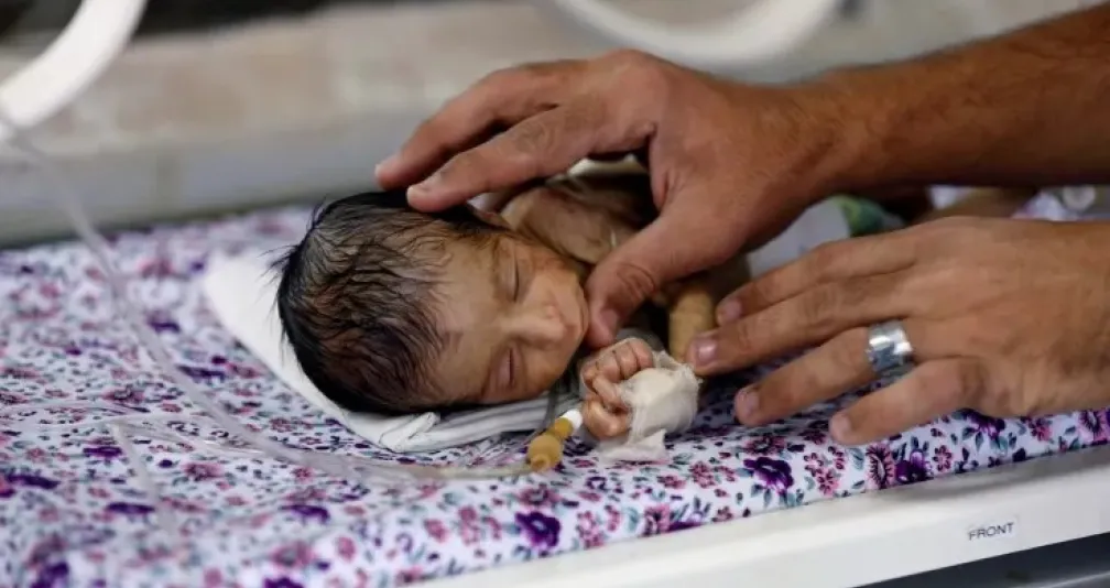 الأوبئة في اليمن تقاوم نظاماً صحياً يعيش في حالة طوارئ