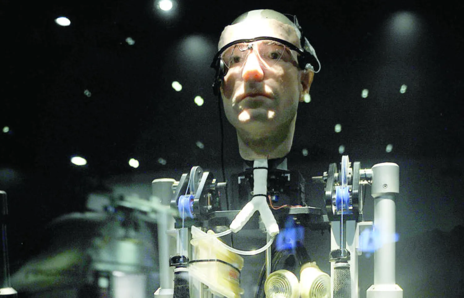 «فرانك».. رجل «بيوني» بأعضاء صناعية متطورة