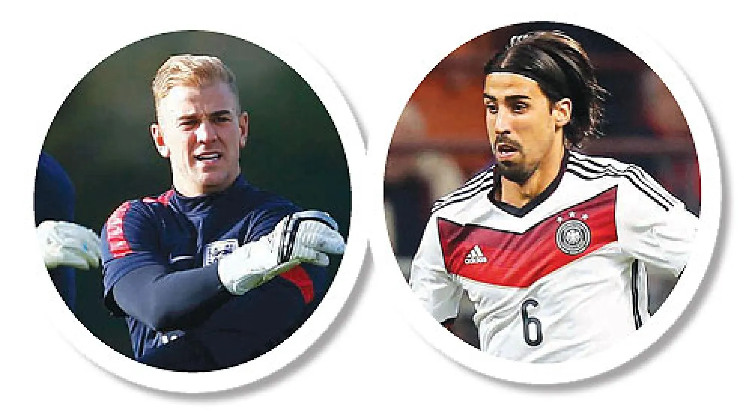 خضيرة خضع لجراحة قد تبعده ستة أشهر و هارت يعود لحراسة إنجلترا رغم أزمته مع سيتي