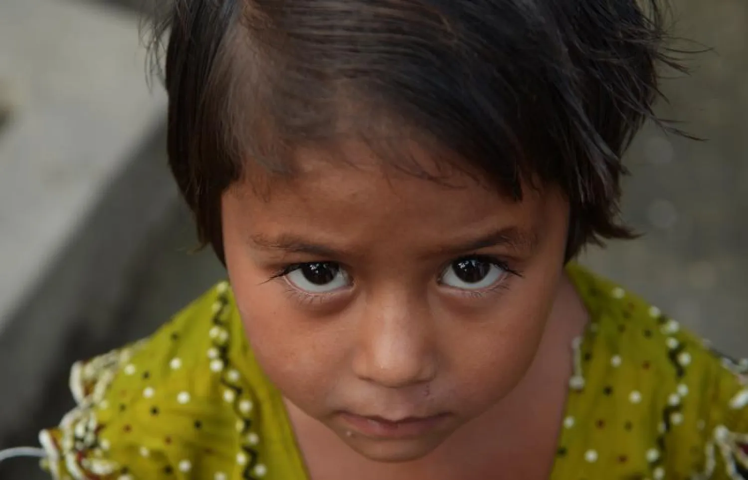 الهند تعلن القضاء بشكل نهائي على «شلل الأطفال»