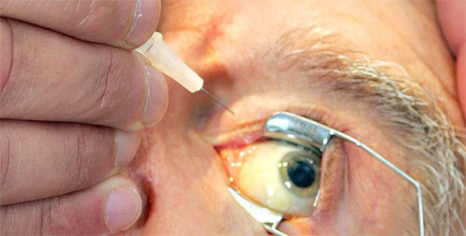 حقنة في شبكية العين تعيد الأمل لفاقدي البصر