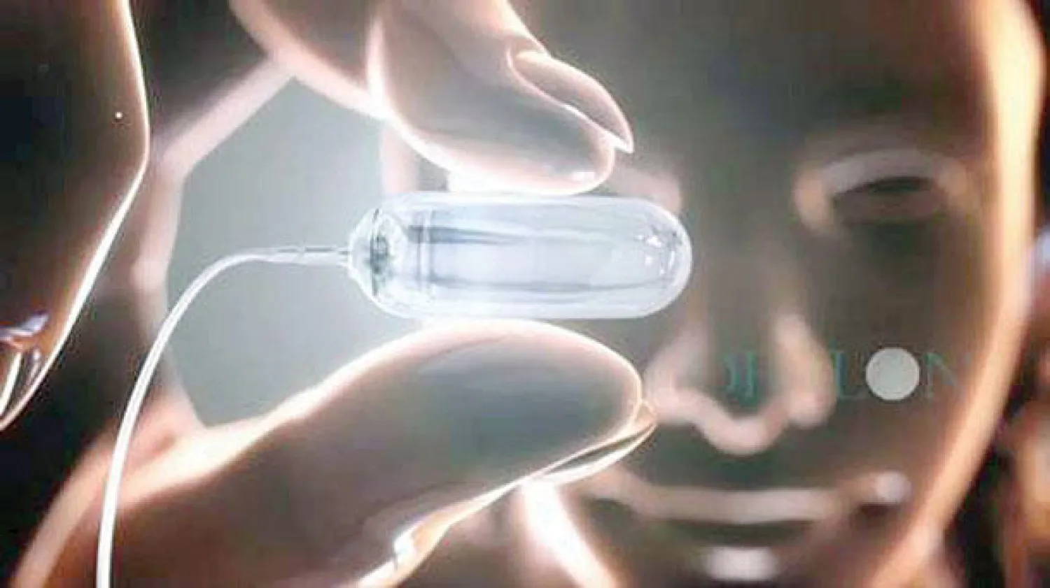 تقنية جديدة لبالون يملأ المعدة.. لعلاج السمنة والبدانة