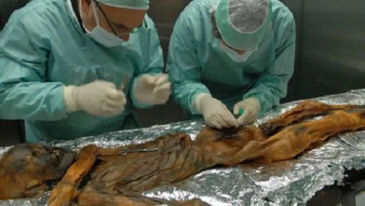 علماء يكتشفون في معدة رجل أقدم قطعة جبن في العالم