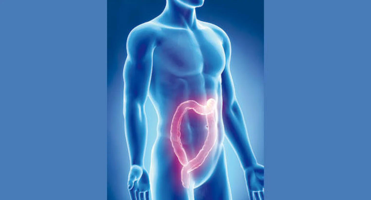 سرطان القولون والمستقيم.. وسبل الوقاية منه