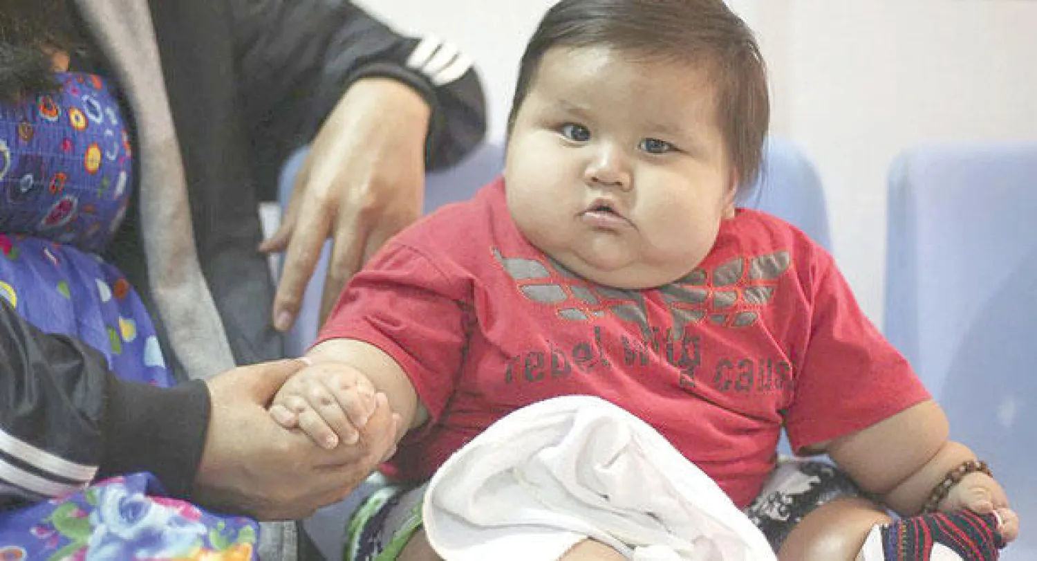 رضيع كولومبي يعالج من السمنة