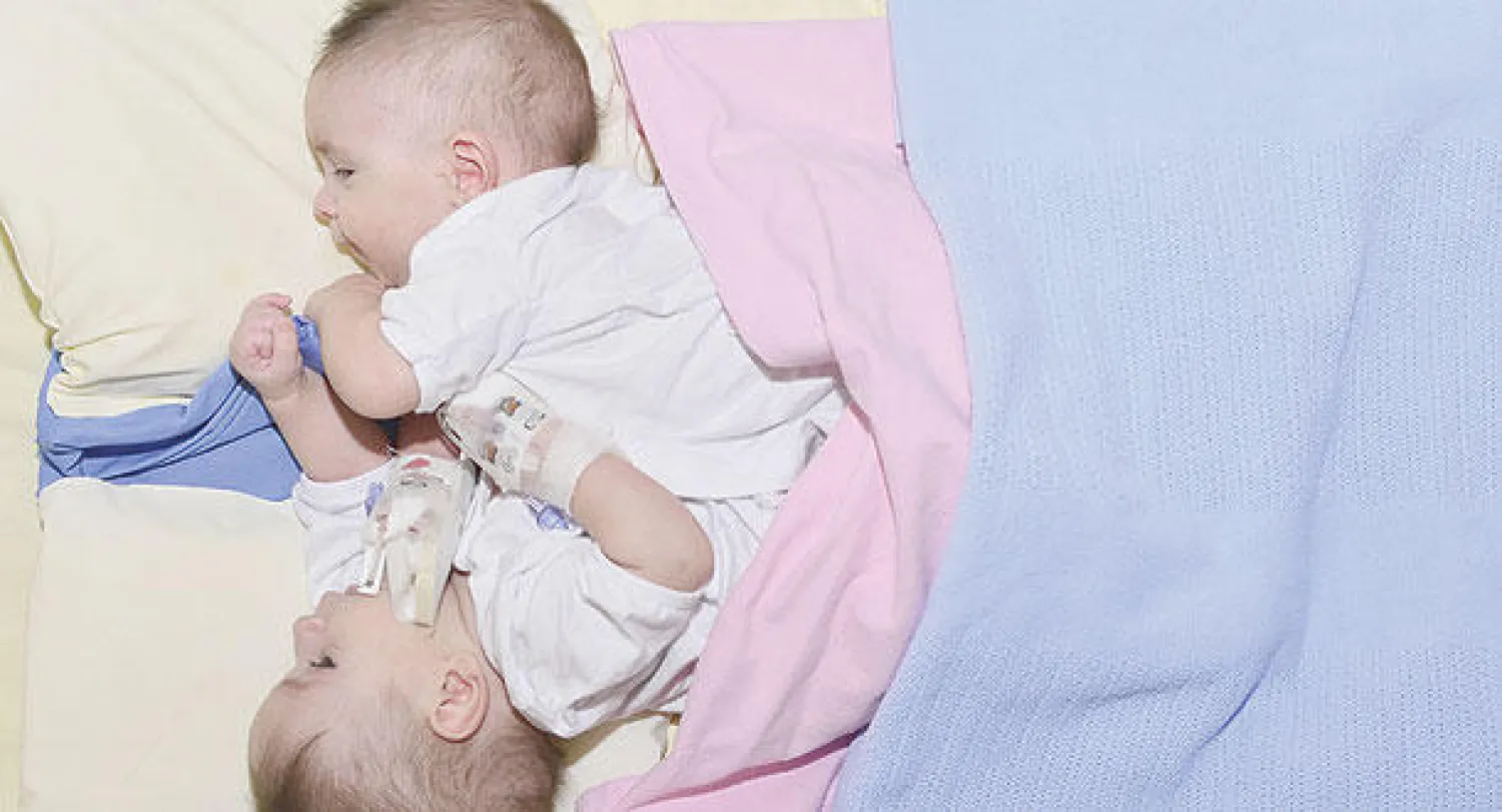 التوأم العراقي كريس وكرستيان