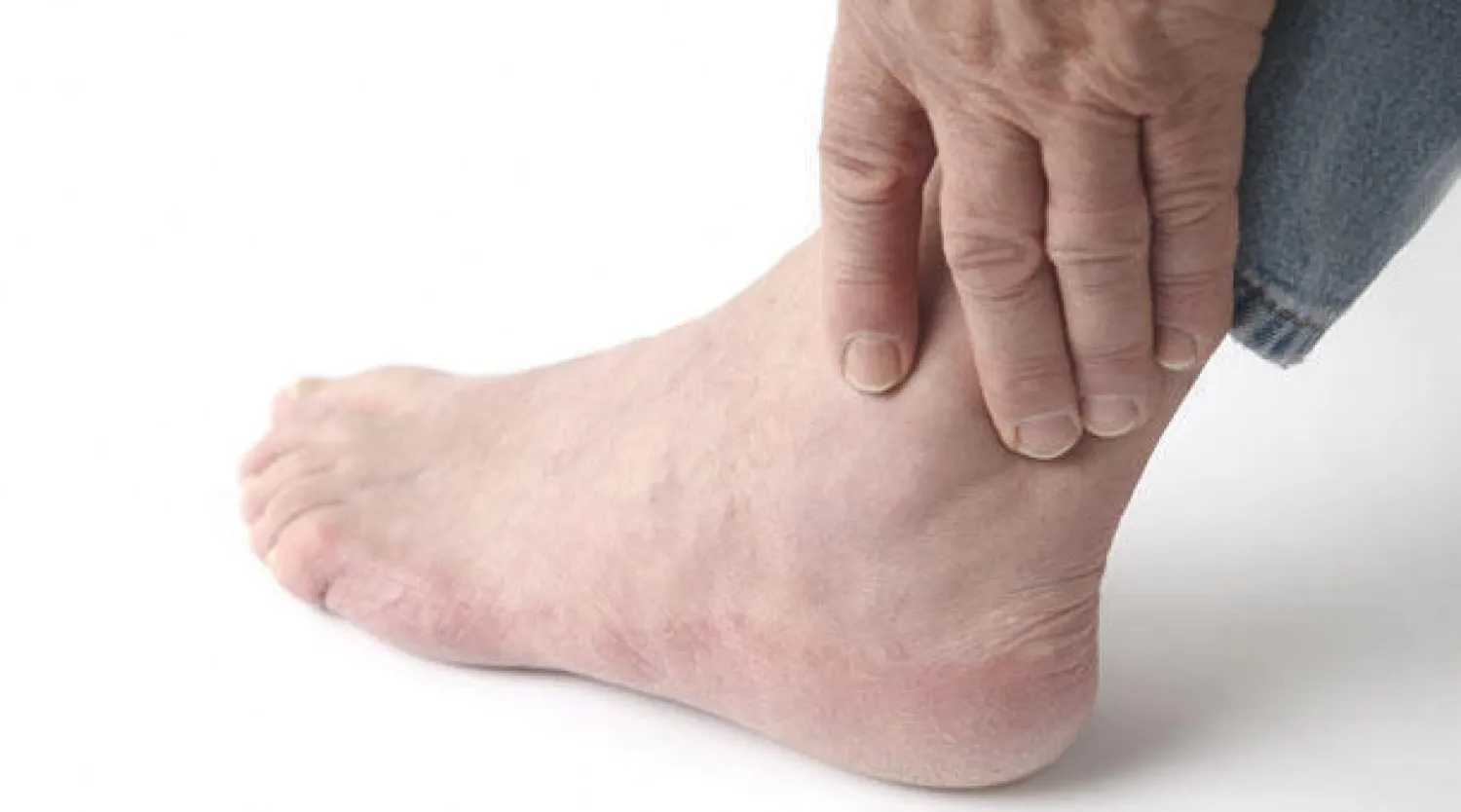 النقرس.. الأعراض والعلاج