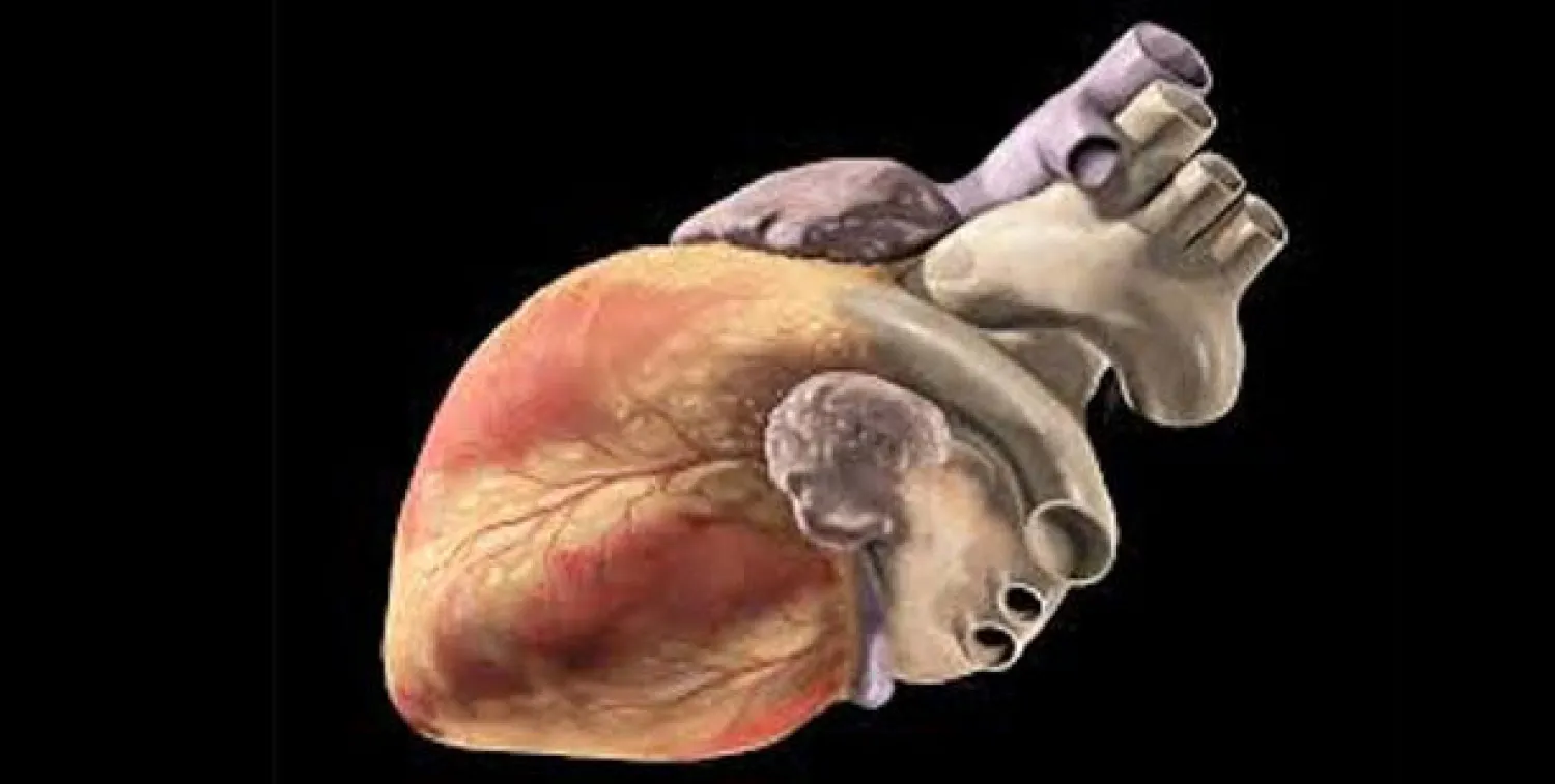 تعرف على آلام أمراض القلب والأوعية الدموية