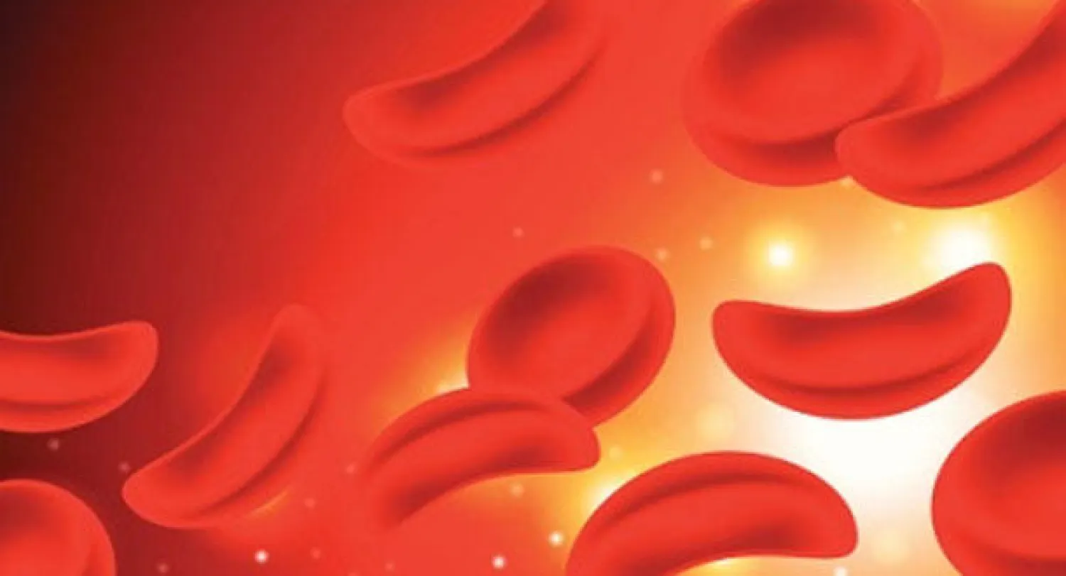 بنك للخلايا الجذعية لمحاصرة مرض الدم المنجلي