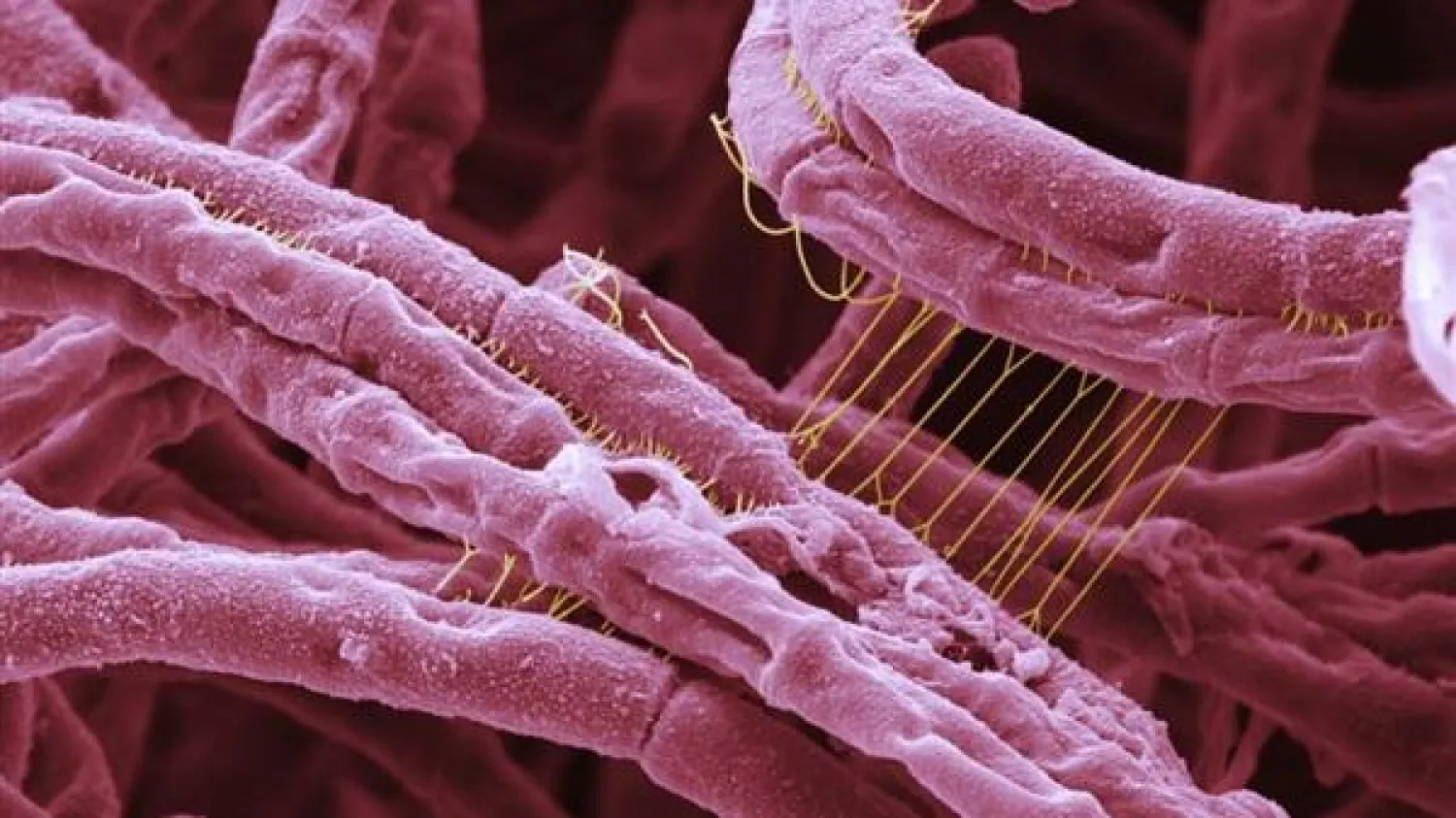 بحوث للتأكد من نجاح عملية قتل فيروس الجمرة الخبيثة