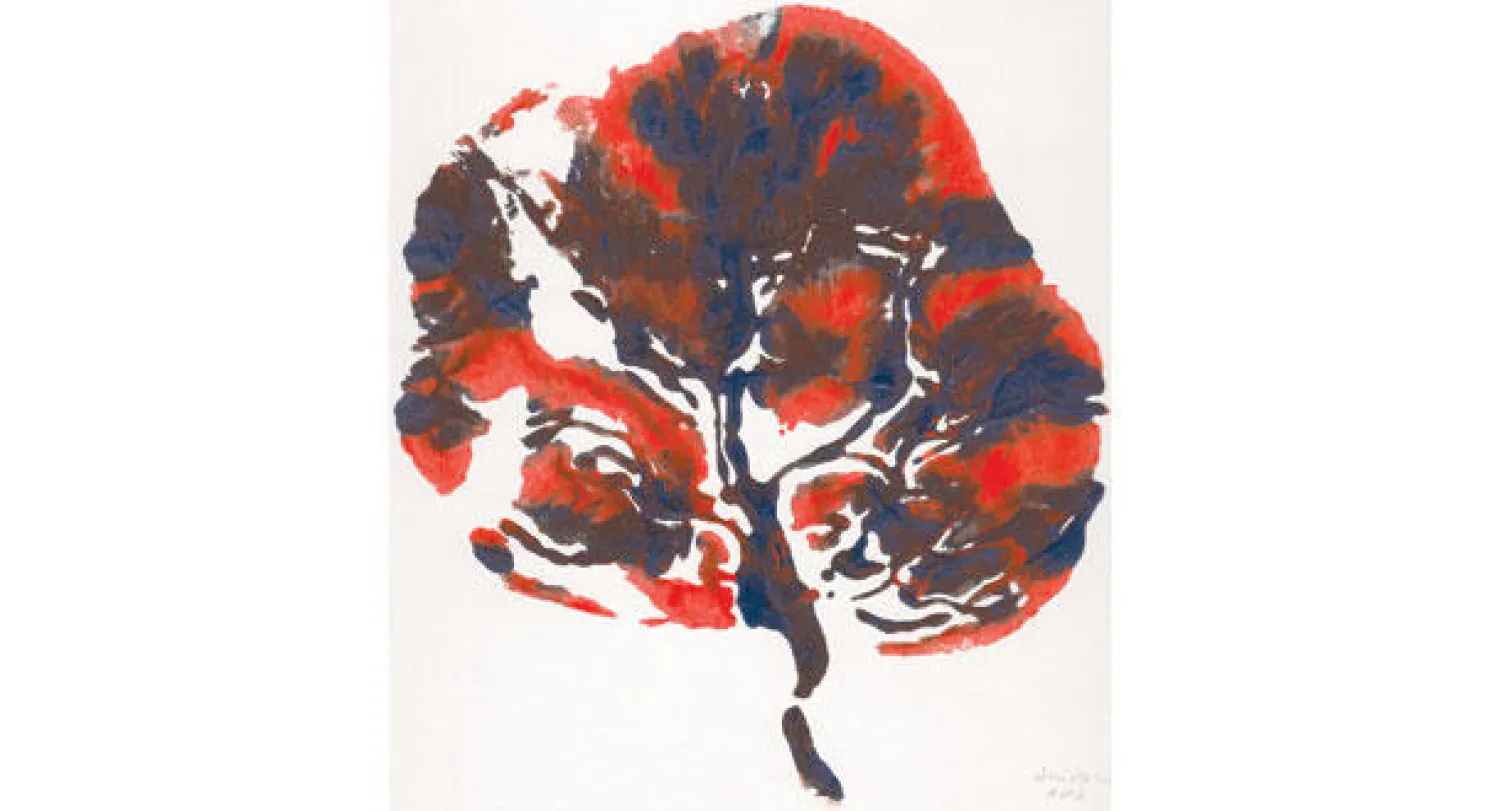 المشيمة.. «شجرة حياة الطفل الوليد»