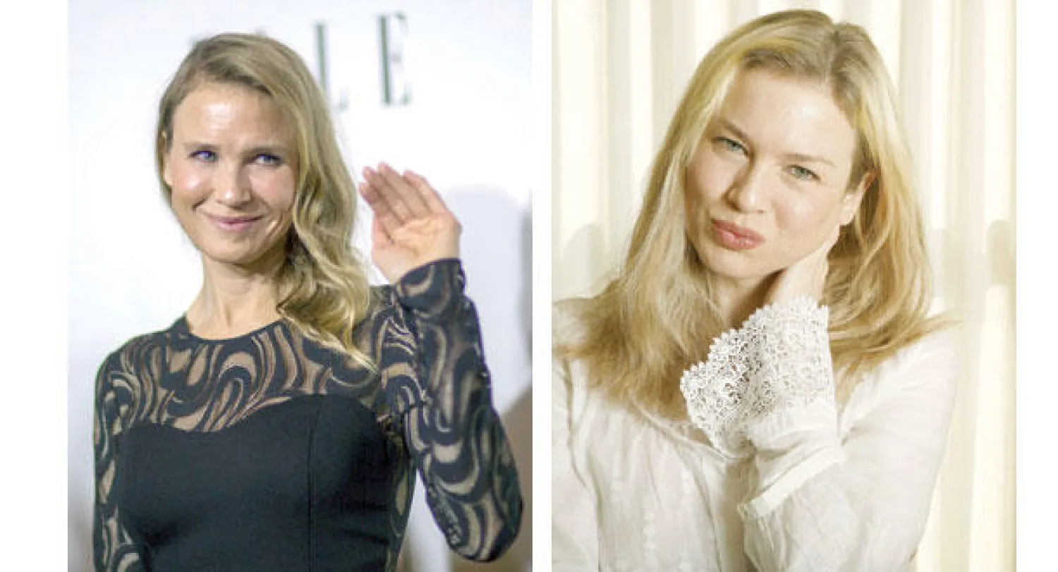 رينيه زيلويغر.. قبل وبعد