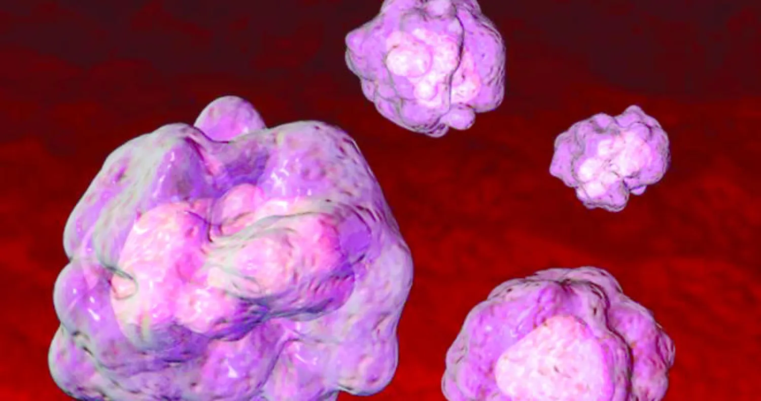 العلاج بالخلايا الجذعية.. بين النجاح والفشل