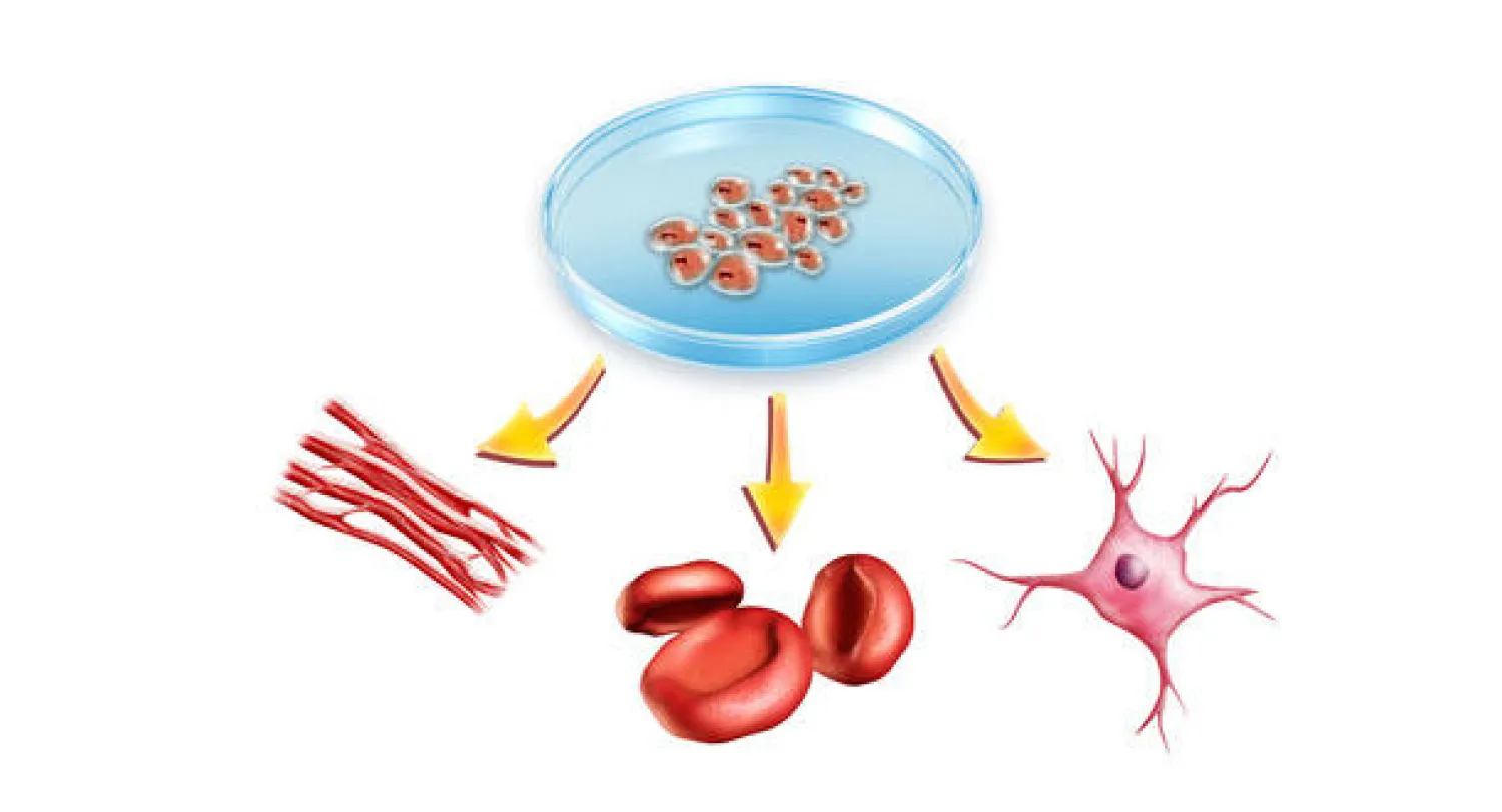 علاج يستخدم زرع الخلايا لعكس حالة الشلل