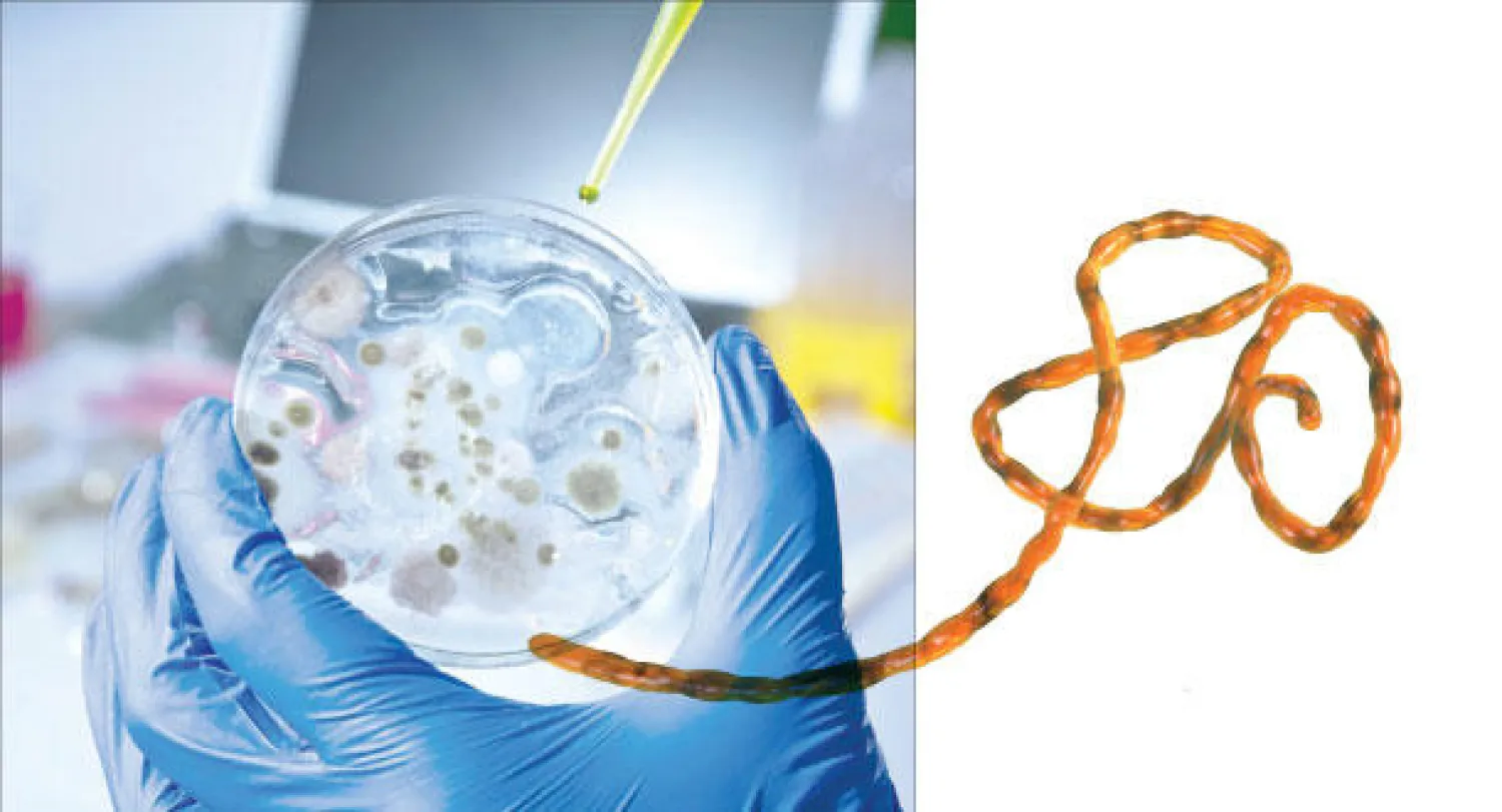 عدوى «إيبولا».. هل تنتقل عبر الرذاذ أو الهواء؟