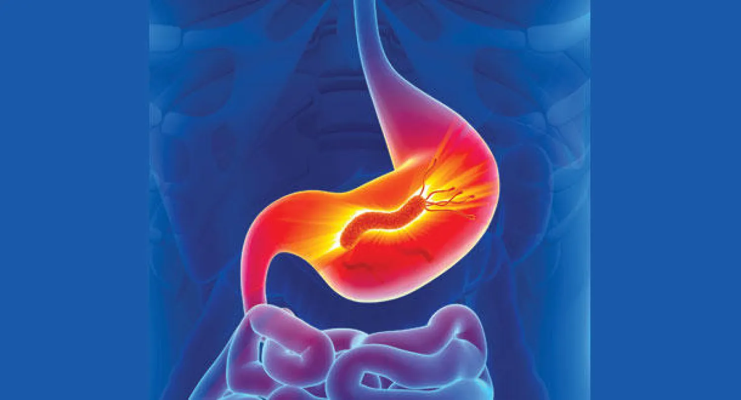 مركب في الزيوت النباتية.. يدمر الجرثومة الحلزونية المسببة لقرحة وسرطان المعدة