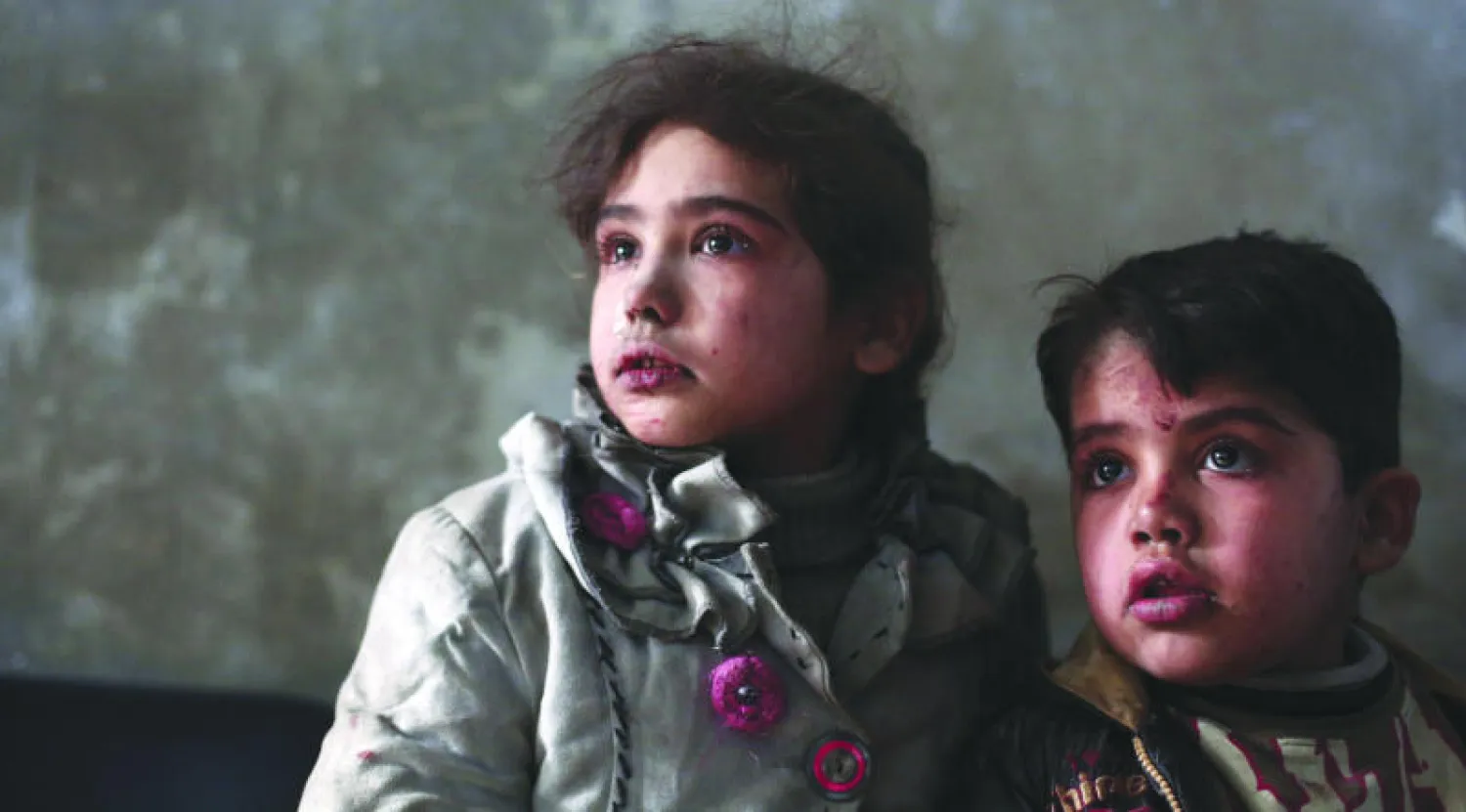 طفلان ينتظران العلاج في المستشفى الميداني بعد إصابتهما إثر غارة جوية شنتها القوات الموالية للنظام السوري في حي (دوما) الواقع شمال شرقي دمشق (أ.ف.ب)