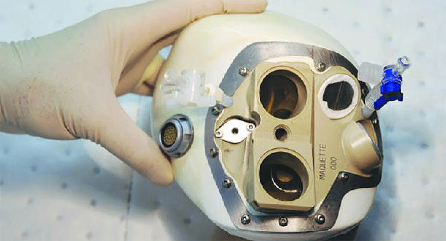 قلب اصطناعي (ا ف ب)