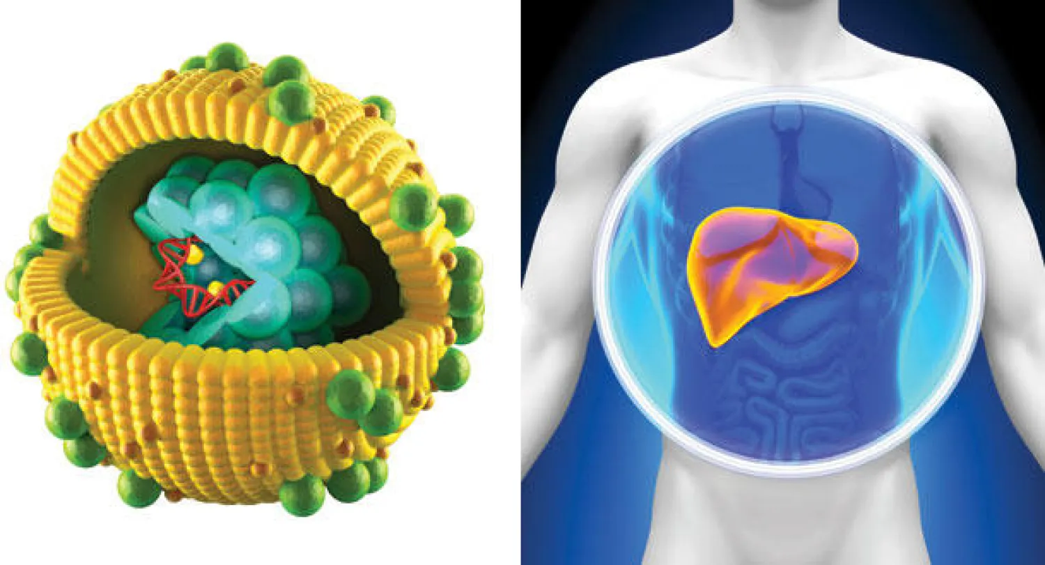 التهاب الكبد الفيروسي «سي».. أحدث تطورات المعالجة