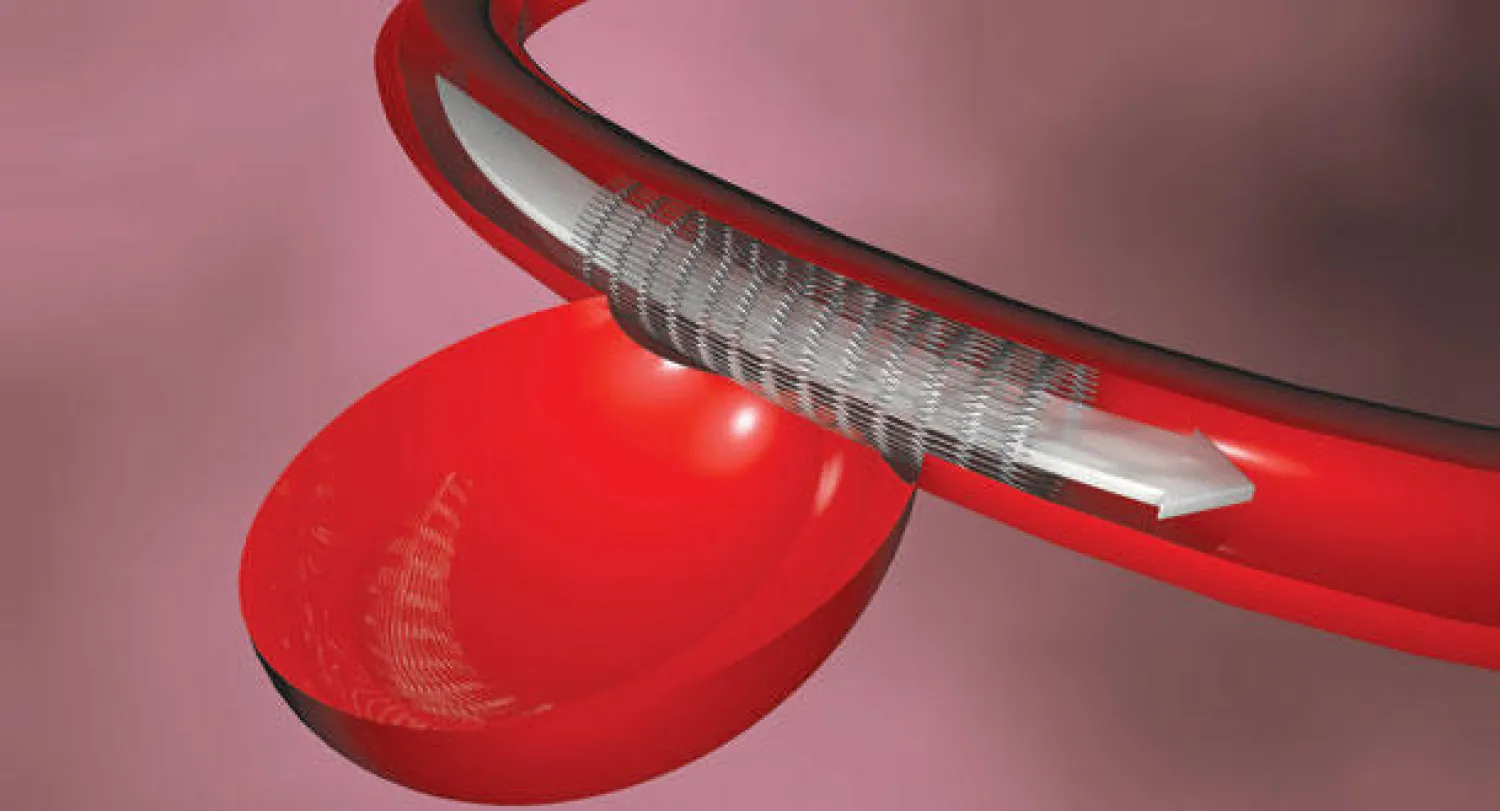 آفاق جديدة في جراحة الأوعية الدموية الدماغية وقاع الجمجمة