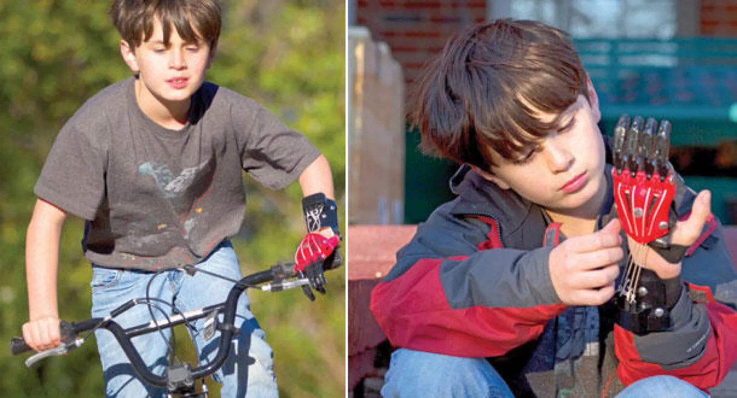 أيادٍ وأطراف صناعية من طابعات ثلاثية الأبعاد