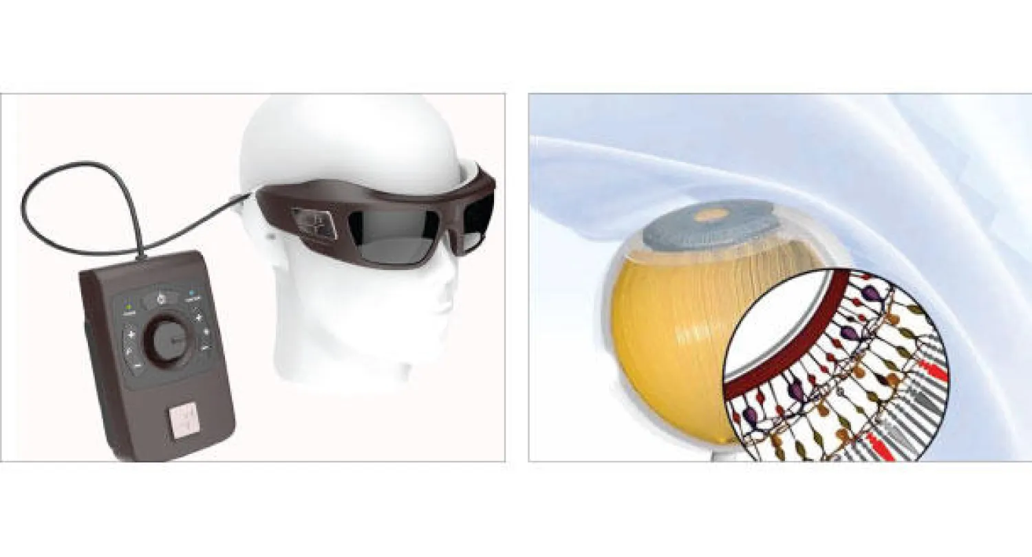 مستشعرات تزرع في العين لاستعادة وظيفة البصر