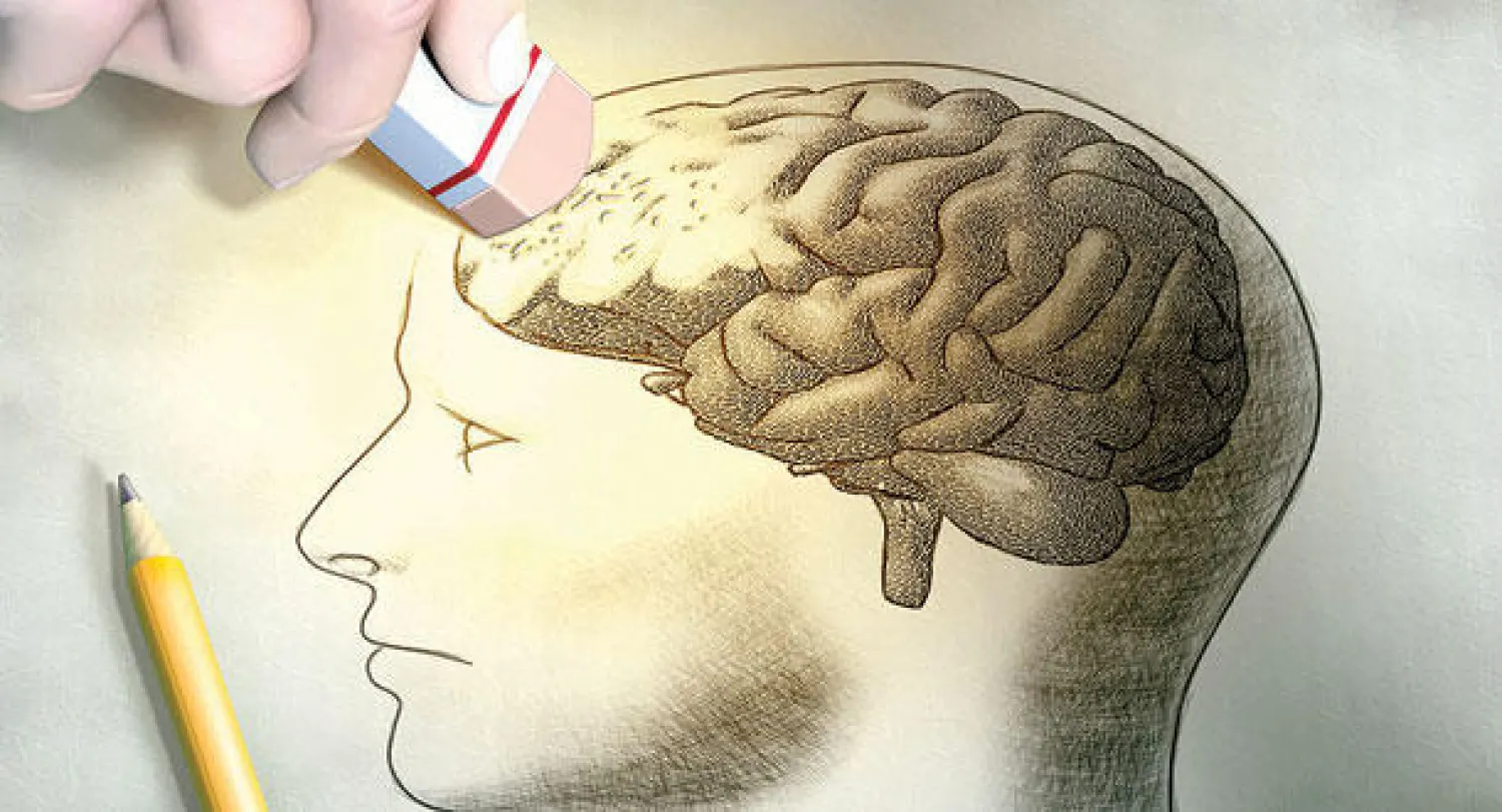 فقدان الذاكرة لا علاقة له بألزهايمر