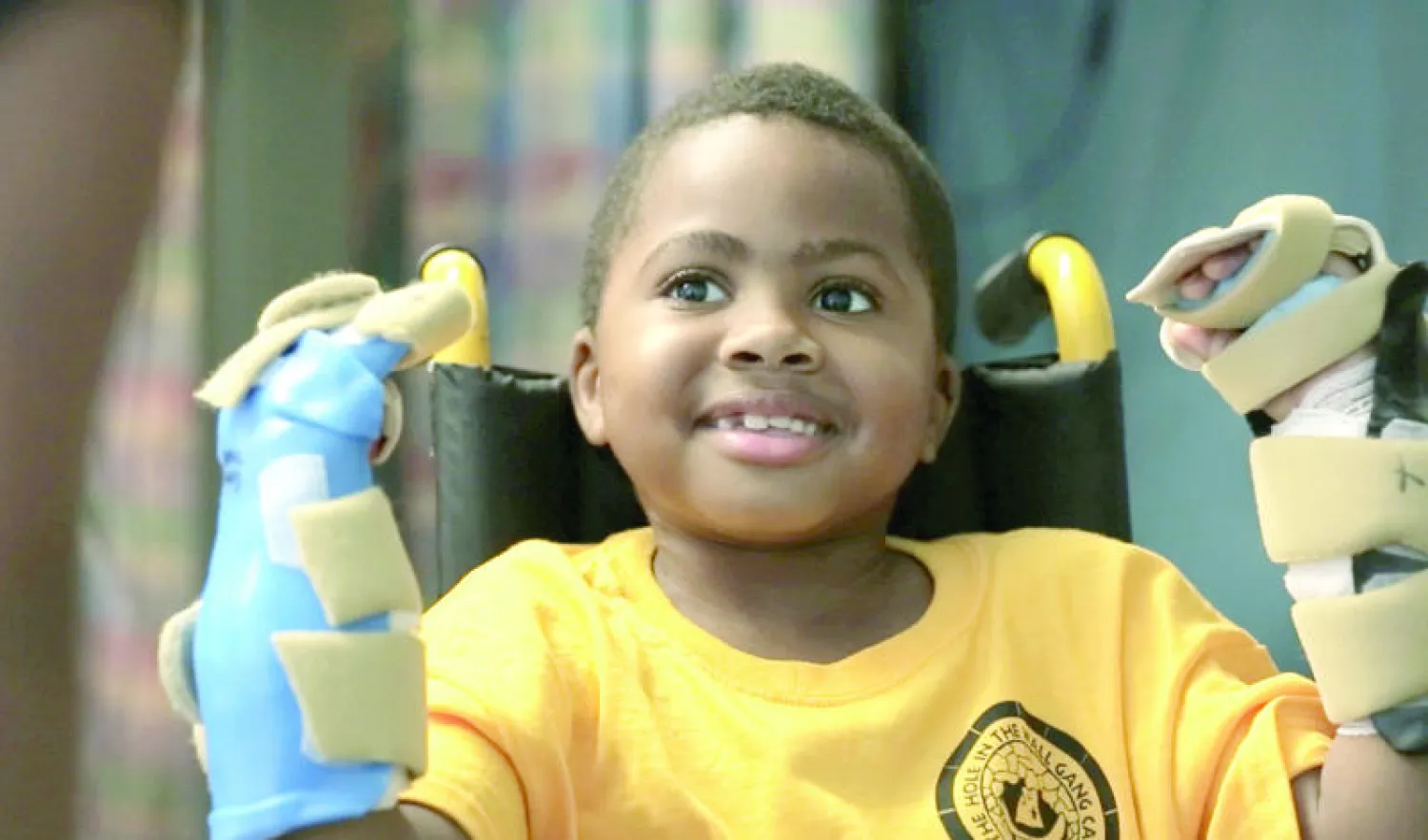 الطفل زاين هارفي يبدو سعيدا بيديه المزروعتين (صورة من مستشفى فيلادلفيا للأطفال)