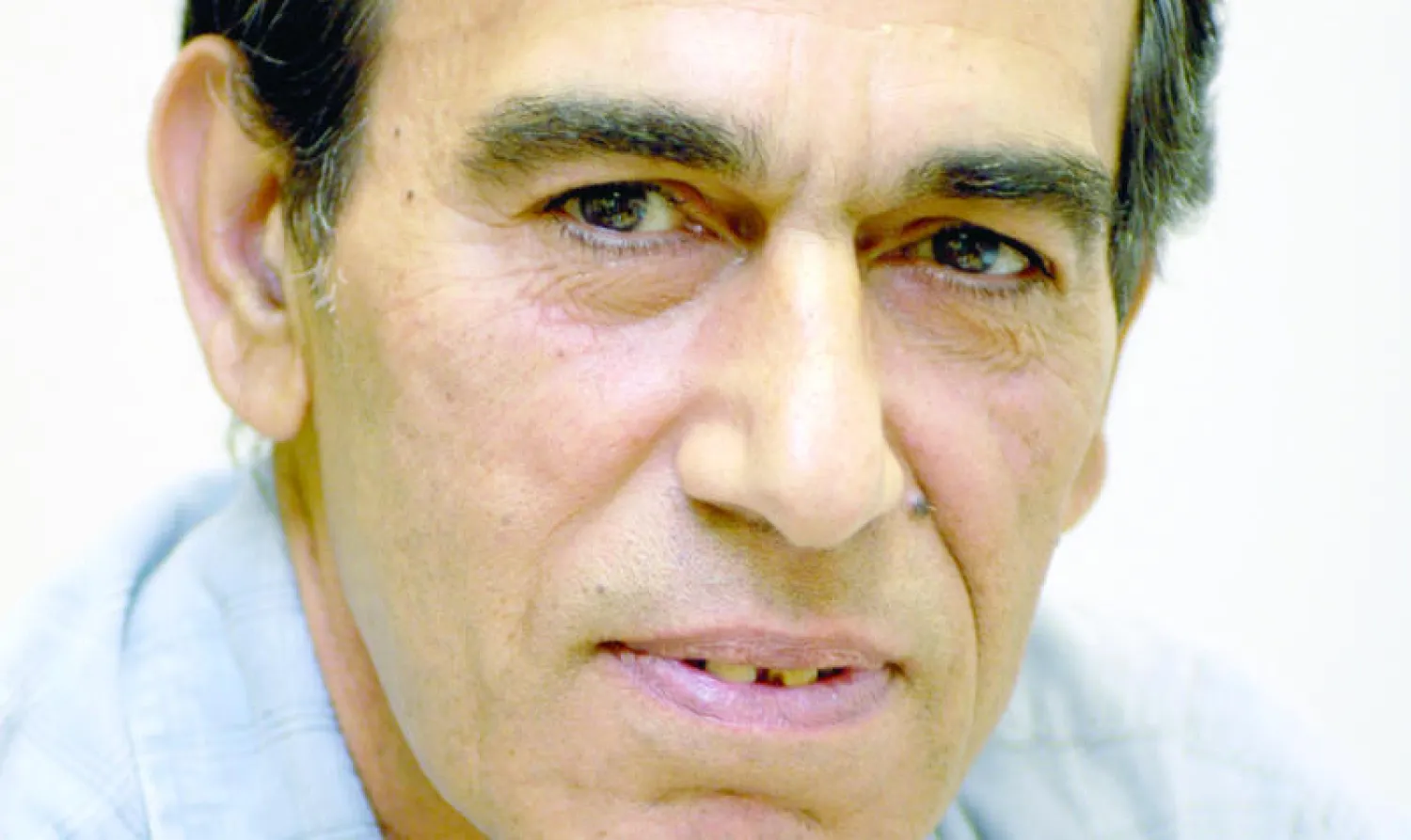 الشعر مريض عالميا