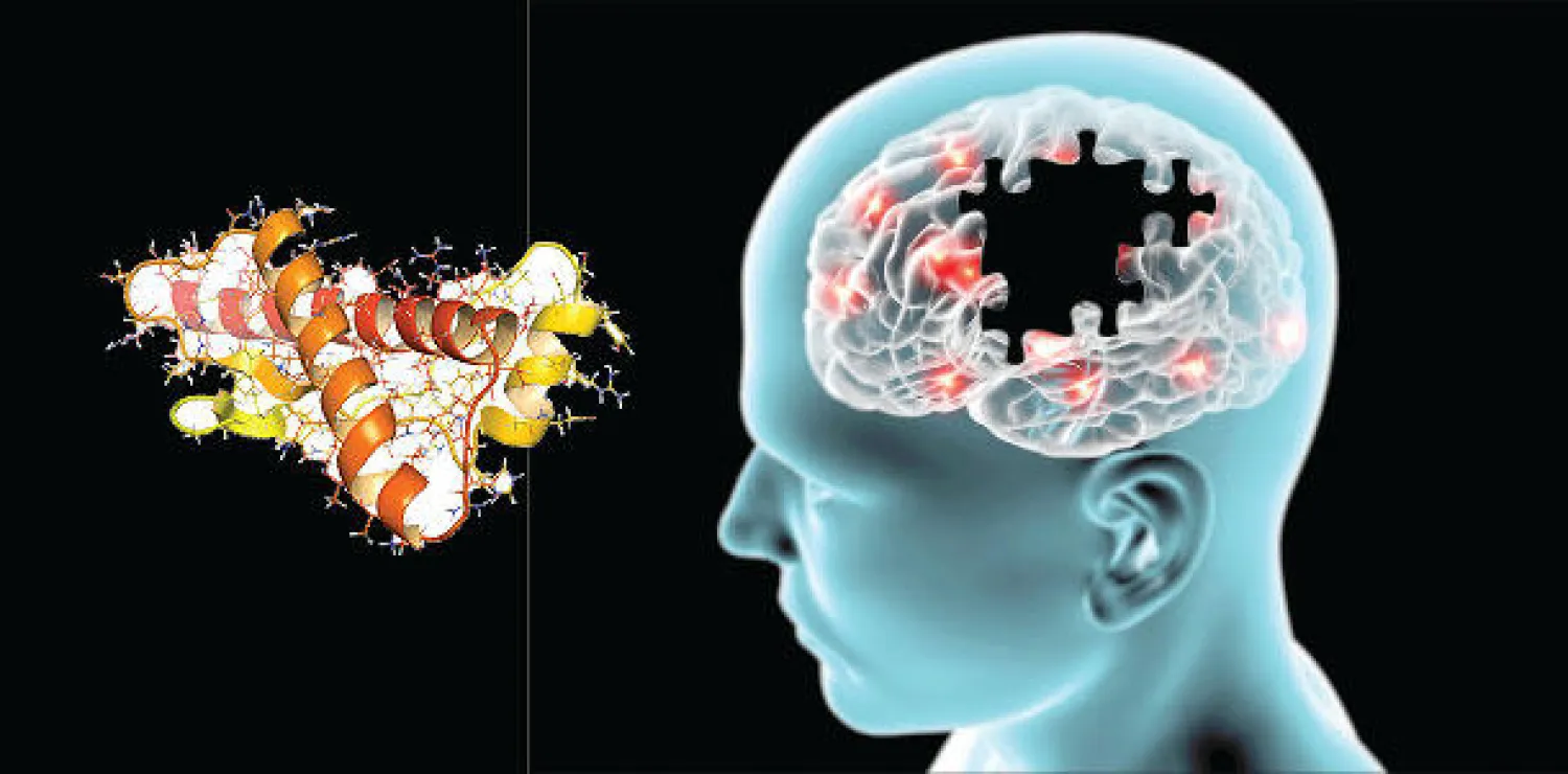 دراسة مثيرة للجدل: مسببات {ألزهايمر} قد تنتقل عبر الأدوات والعمليات الجراحية الملوثة