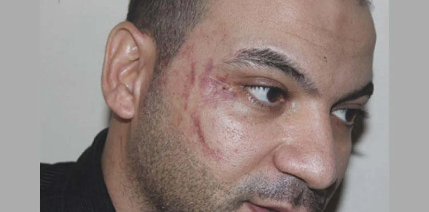 المصري المعتدى عليه خالد السيد عثمان («الشرق الأوسط»)