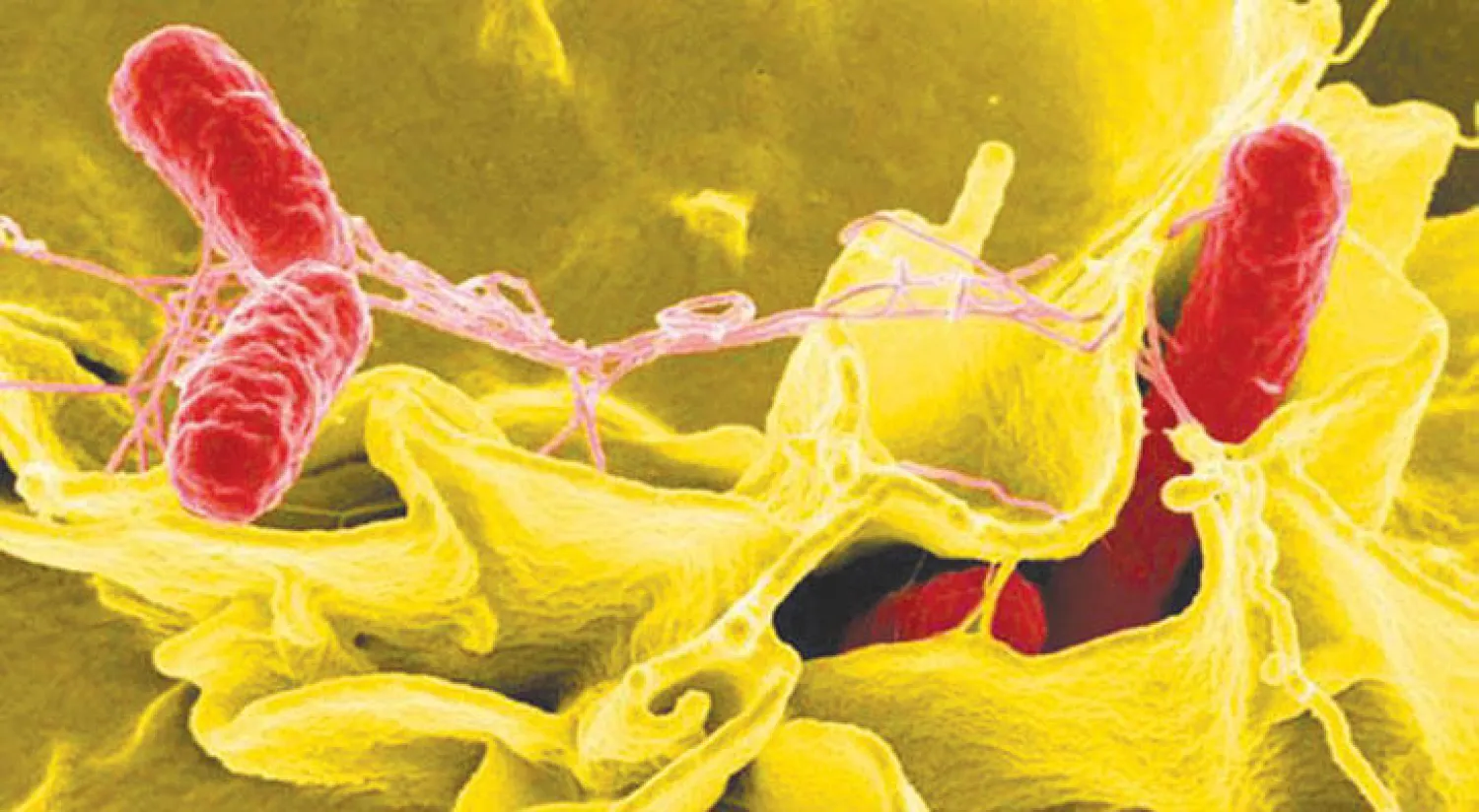 البكتيريا الخارقة قد تطور عدوانيتها من خلال تنقلها بين البشر والحيوانات