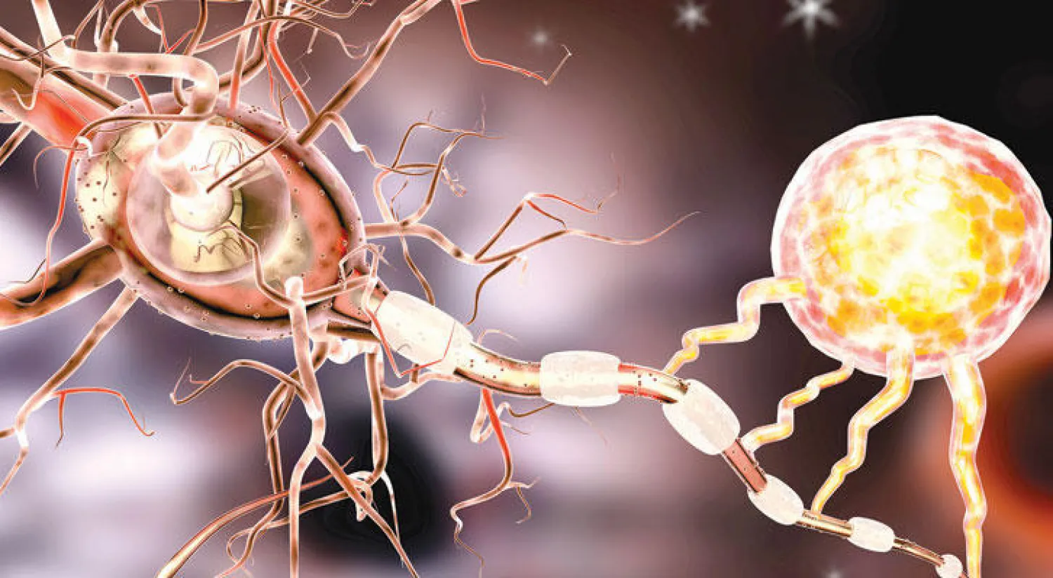 الخلايا العصبية تتعرض لهجوم جهاز المناعة عند الإصابة بمرض التصلب المتعدد