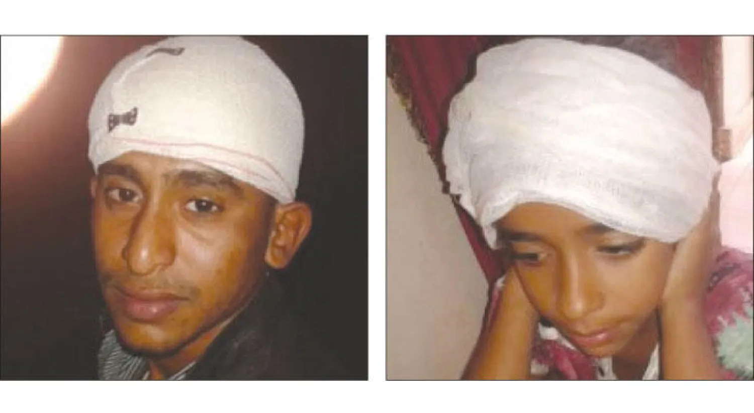 الطفلة خلود والشاب حسام فضل تعرضا لإصابات بالغة جراء تطاير زجاج النوافذ في موقع انفجار مبنى الأمن العام وسط مدينة لحج