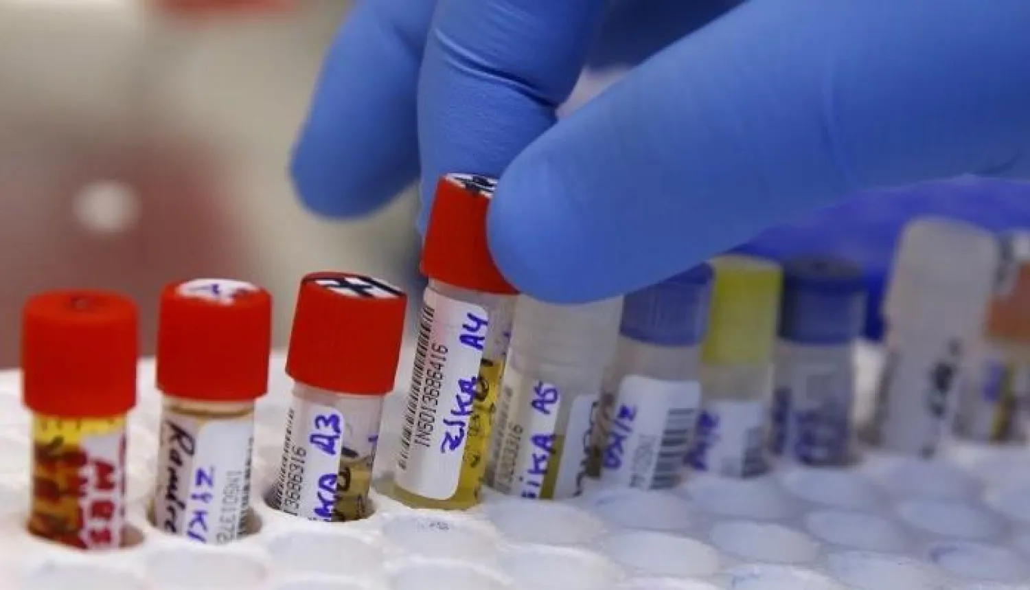 تسجيل إصابة بفيروس «زيكا» عن طريق ممارسة الجنس في تكساس