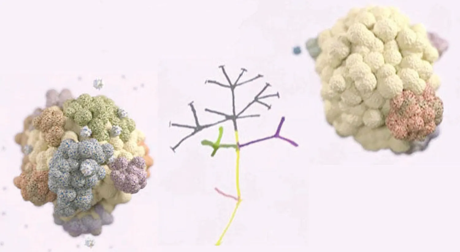 ورم سرطاني وبجانبه «شجرة نموه»  -  نسيج وتبدو فيه خلايا سرطانية
