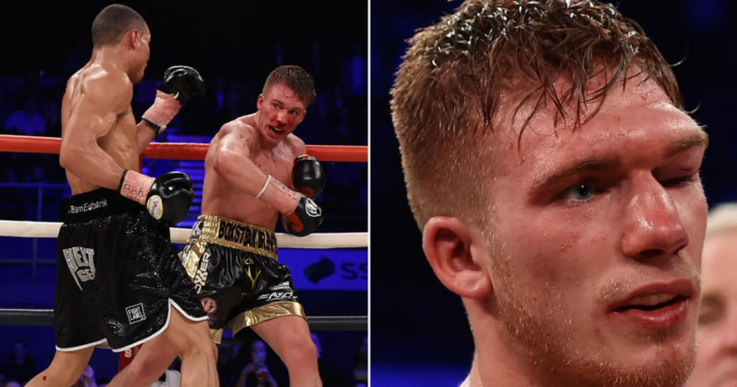 الملاكم البريطاني بلاكويل يدخل في غيبوبة بعد هزيمته من أيوبانك