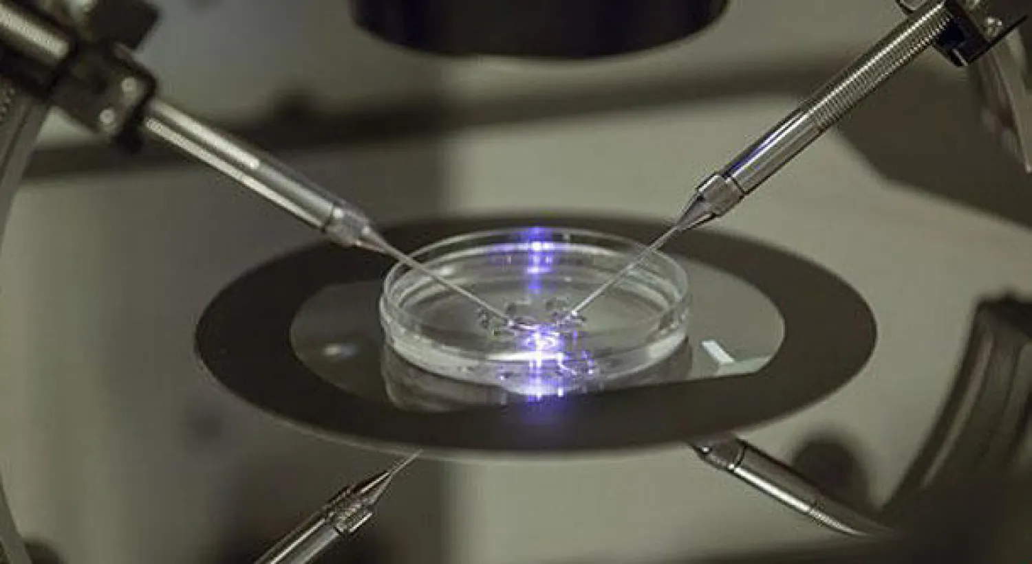 15 % من الناس يعانون مشكلات العقم