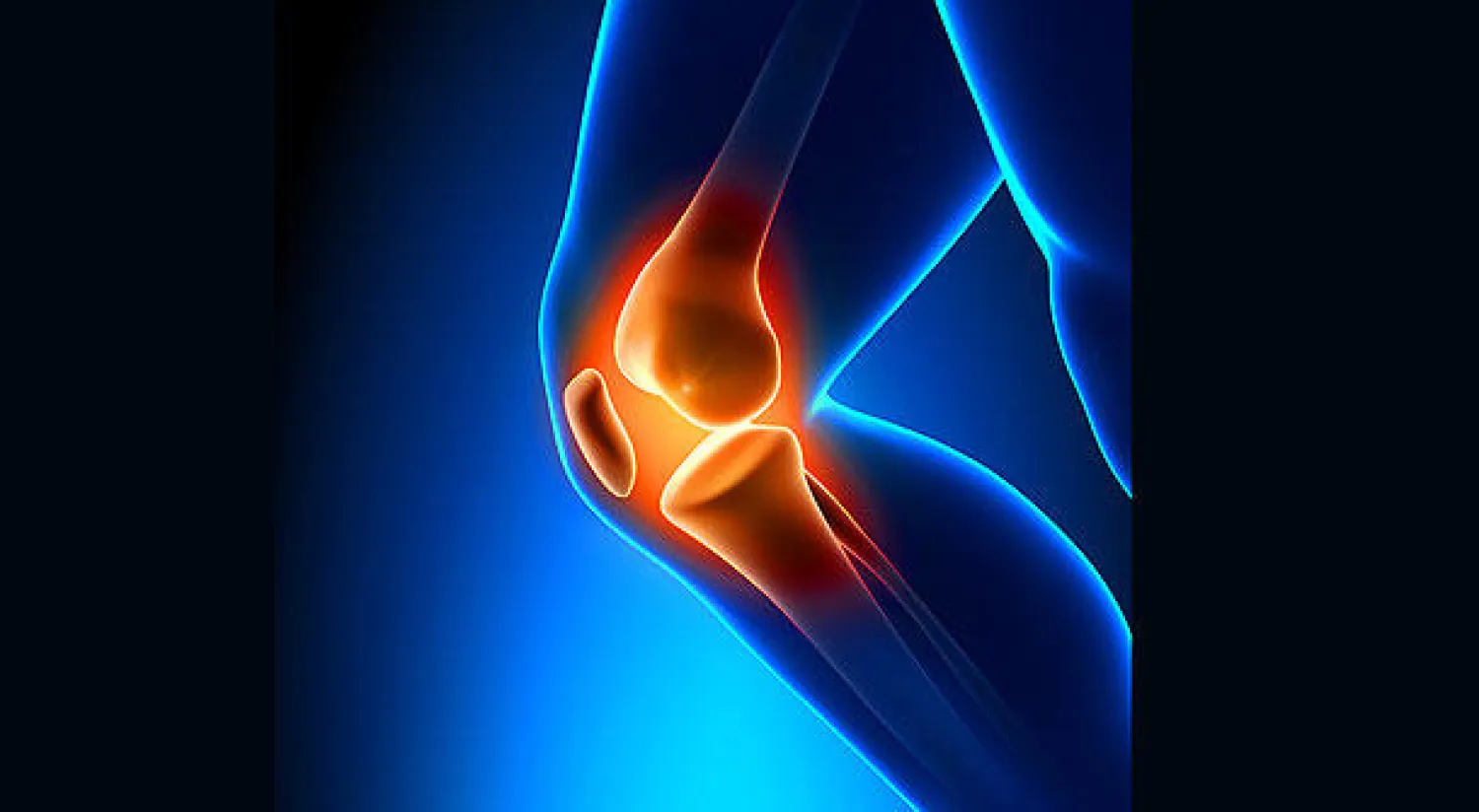 خشونة الركبتين والمفاصل بين الأسباب والعلاج