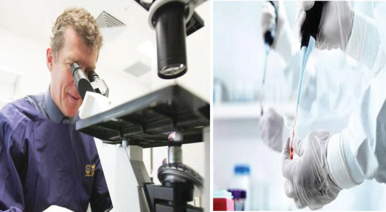 علماء يكتشفون الجين المسؤول عن الإصابة بسرطان البروستاتا