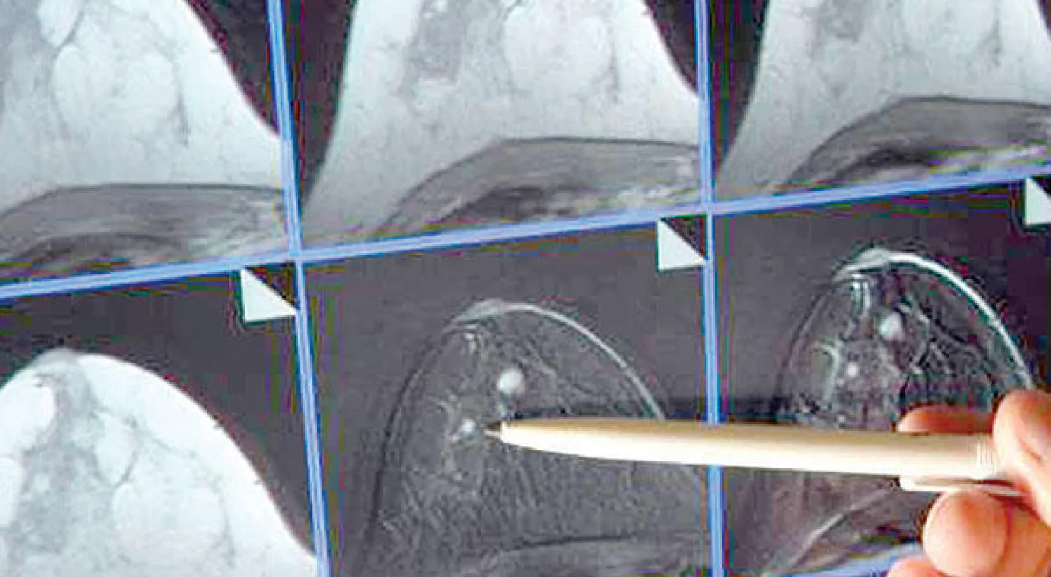 نسبة الخطأ في التشخيص انخفضت في ألمانيا إلى 5 في المائة (د.ب.أ)