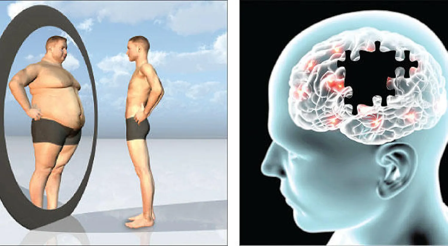 السمنة في الصغر.. تزيد شيخوخة الدماغ 10 سنوات عند أواسط العمر