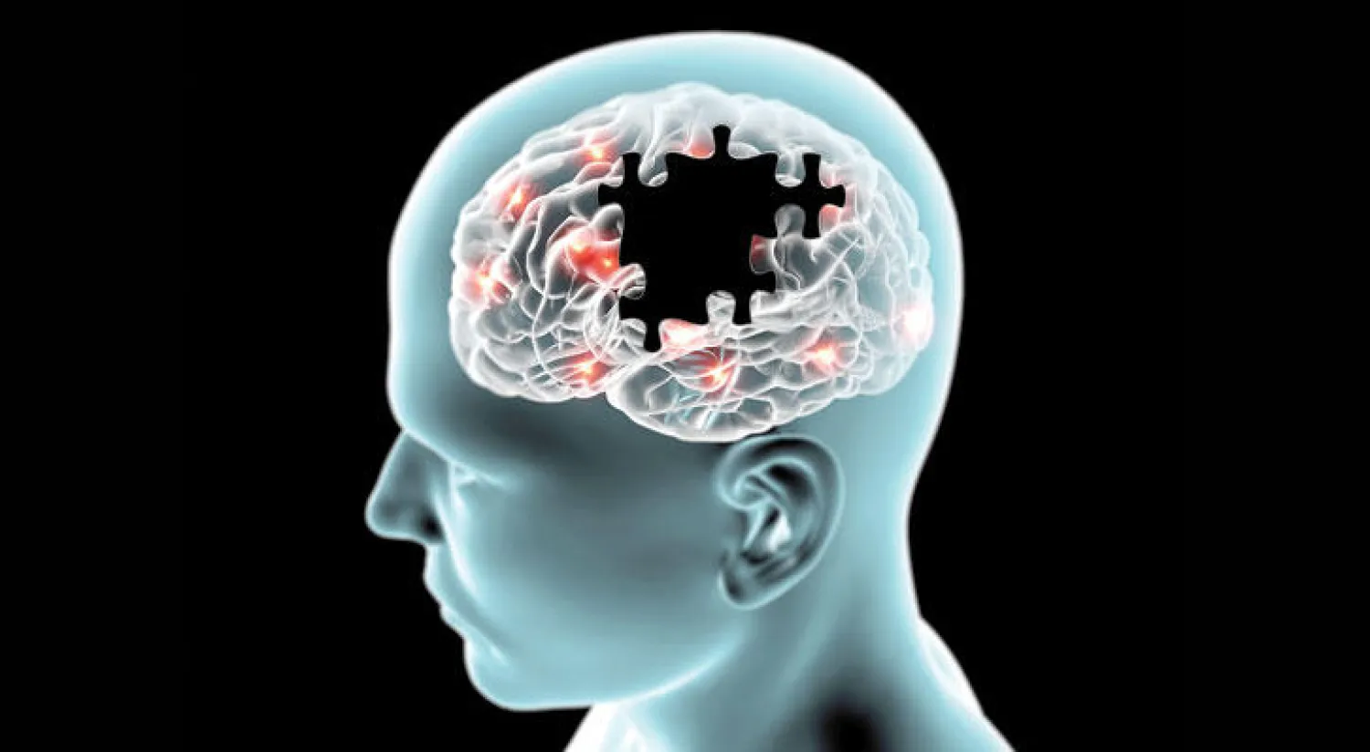 في اختراق علمي مثير: عقار يقضي على مرض ألزهايمر