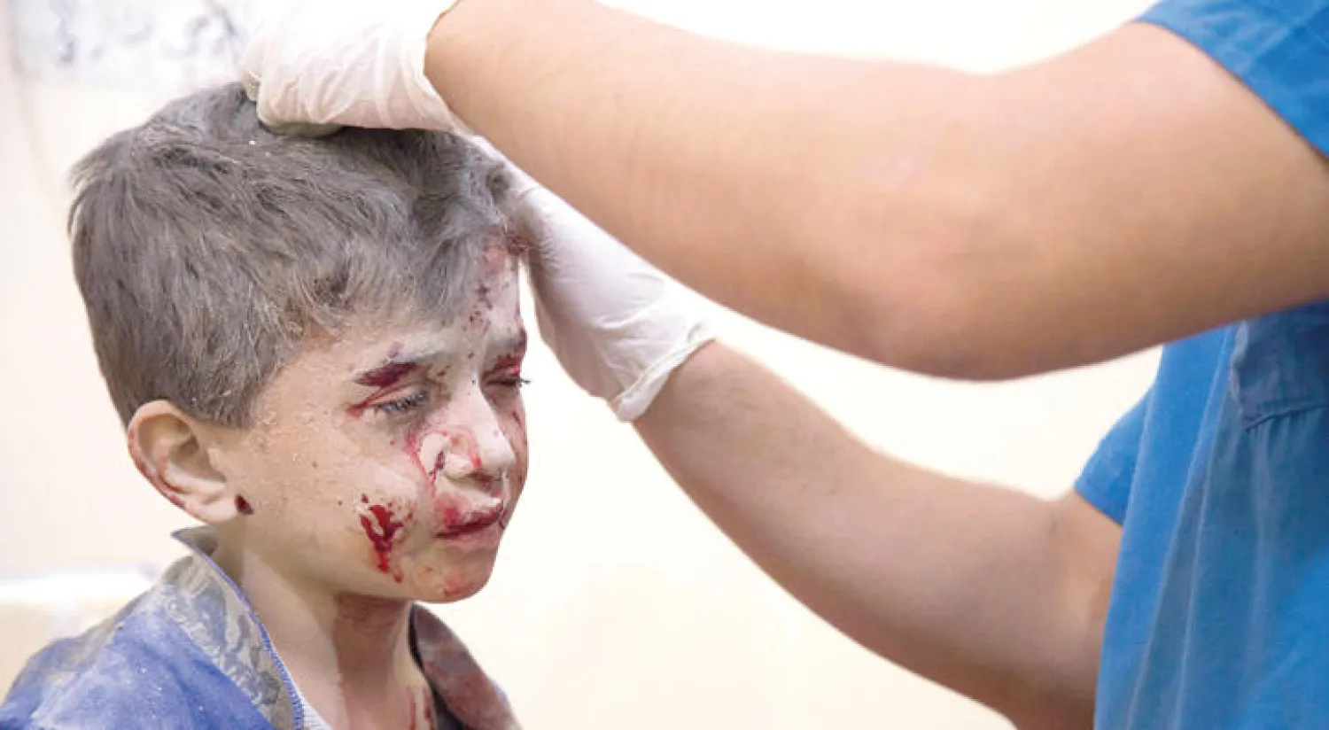 طفل سوري يتلقى العلاج في أحد مستشفيات حلب بعد إصابته في قصف جوي (أ.ف.ب)