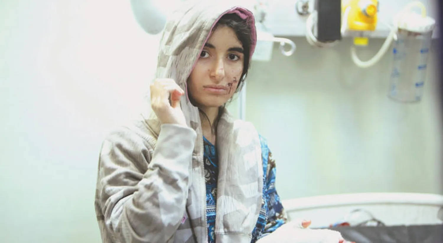 نازحة أصيبت بجروح خلال هروبها من مناطق سيطرة «داعش» في الموصل تتلقى العلاج في مستشفى غرب أربيل أمس (رويترز)