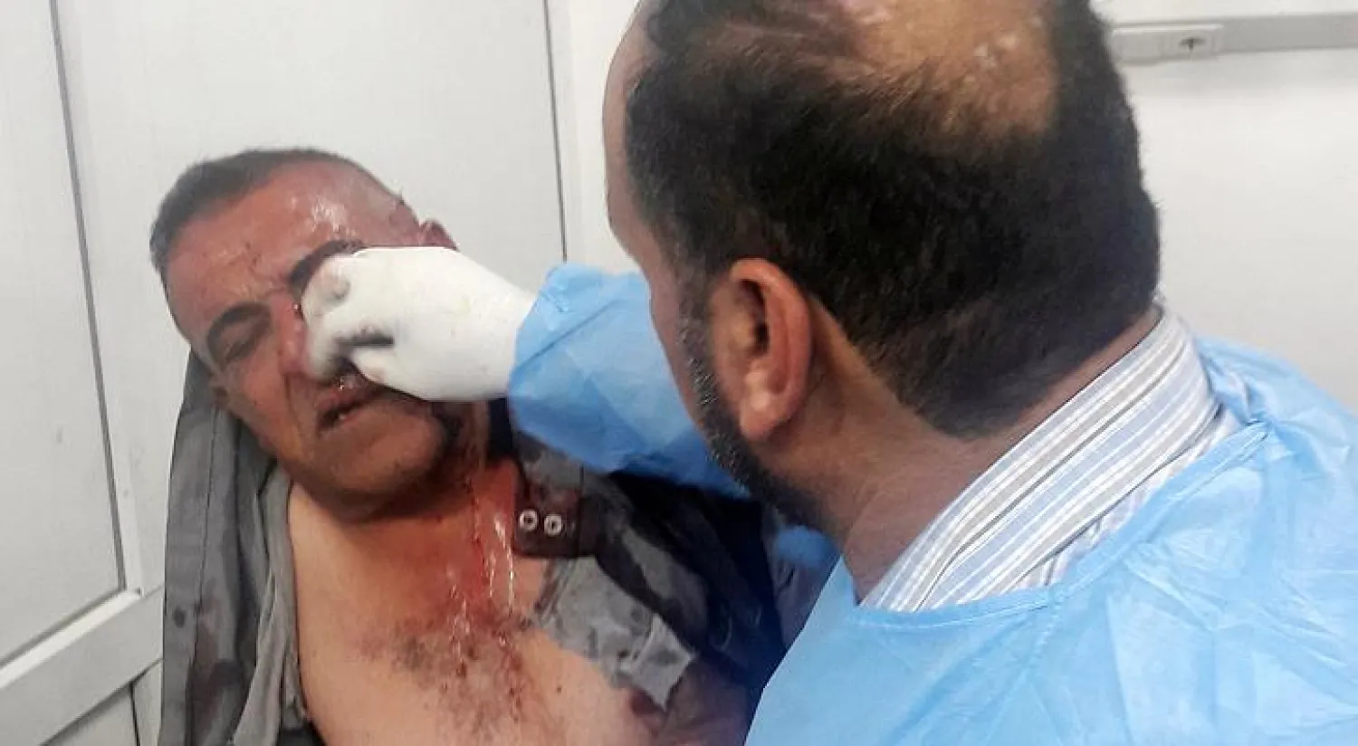 انفجاران يقتلان 8 أشخاص في الفلوجة بالعراق