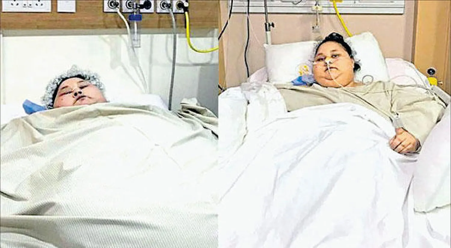 إيمان أحمد عبد العاطي صورة من المستشفى في مومباي قبل العلاج وبعده