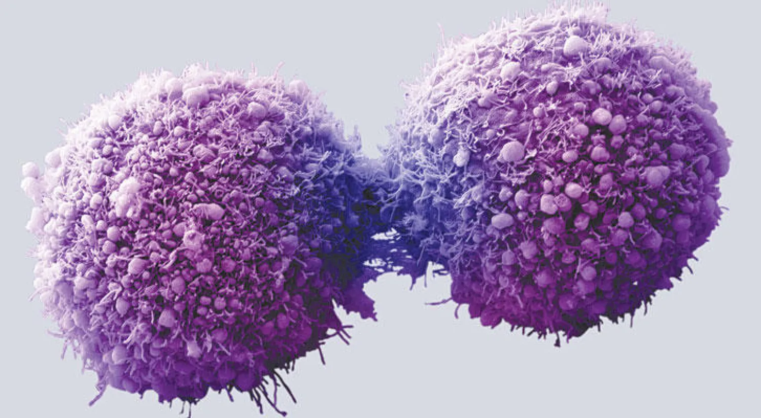 علاج سرطان البروستاتا